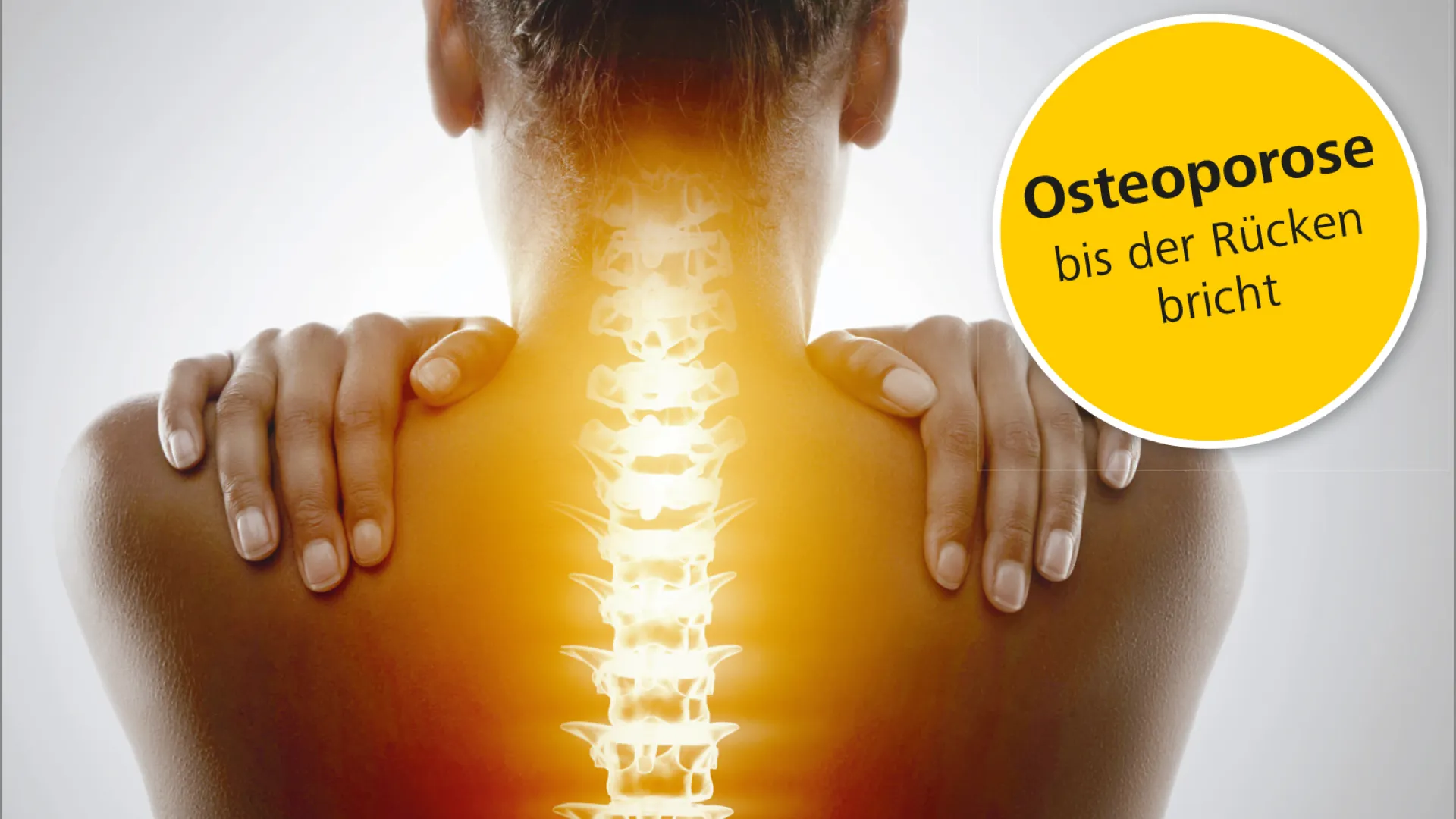 Rückenforum "Osteoporose: bis der Rücken bricht": Schweizer Paraplegiker Zentrum am 18. März 2020
