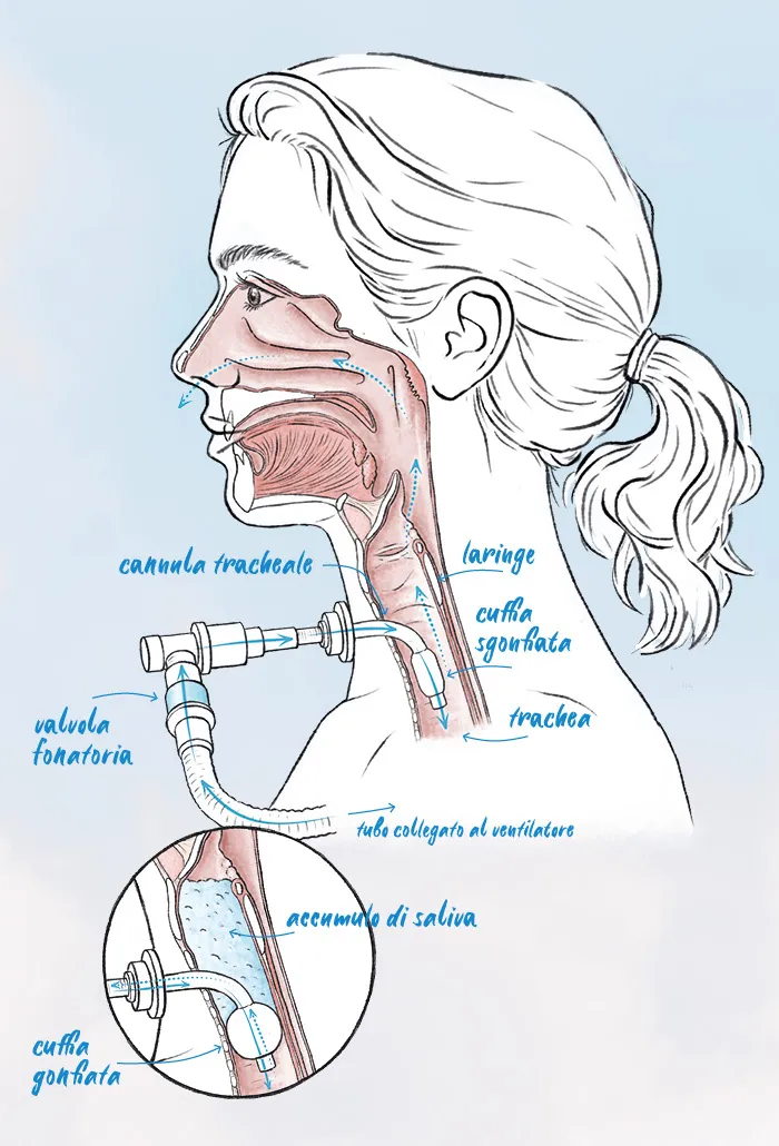 illustrazione