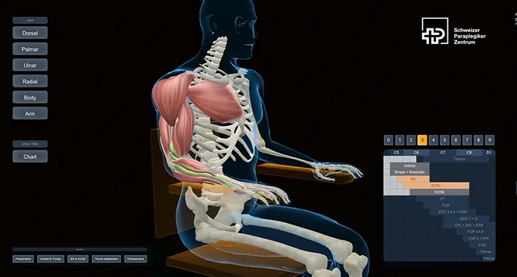 Operation im 3D-Modell: Darstellung der Operationsschritte