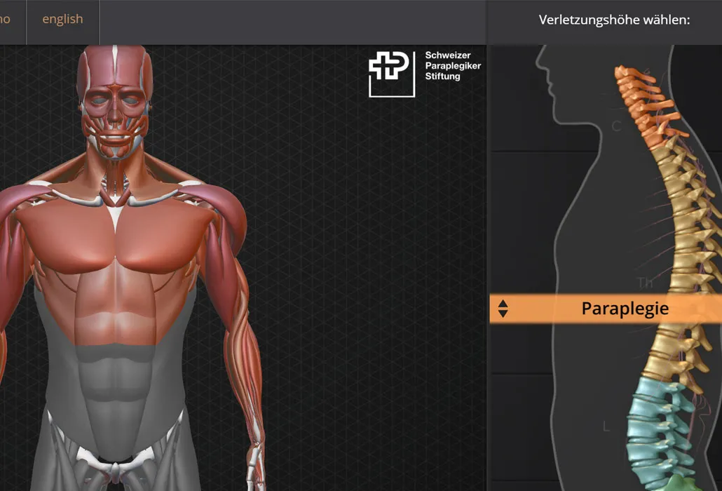 Visualisierung Querschnittlähmung - Schweizer Paraplegiker-Zentrum
